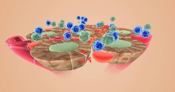 Autoimmune attack on thyroid cells 3D rendering - Foto, Imagem