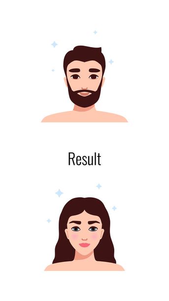 Alopecia hair transplantation composition with infographic image of hair restoration procedures with text vector illustration - Vector, Imagen