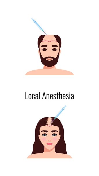 Alopecia hair transplantation composition with infographic image of hair restoration procedures with text vector illustration - Vektor, Bild