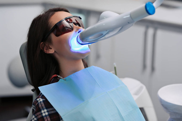 Δόντια λεύκανση για γυναίκα. Η λεύκανση των δοντιών στο οδοντιατρείο. - Φωτογραφία, εικόνα
