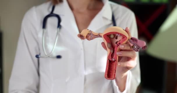 Dokter gynaecoloog houdt een anatomisch model van het vrouwelijke genitale orgaan toont duim omhoog. Goedkeuring en aanbeveling voor de behandeling van vrouwen - Video