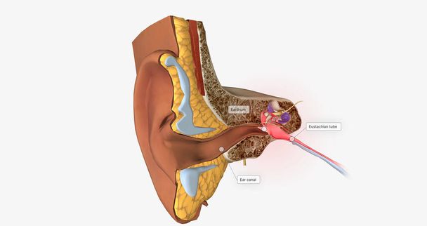 Earache is a general term for pain in the ear.3D rendering - Photo, Image