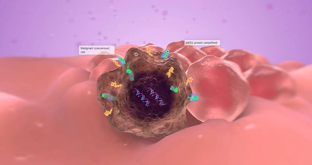 Il gene anormale è conosciuto come un oncogene perché provoca la crescita del tumore. Rendering 3D - Foto, immagini