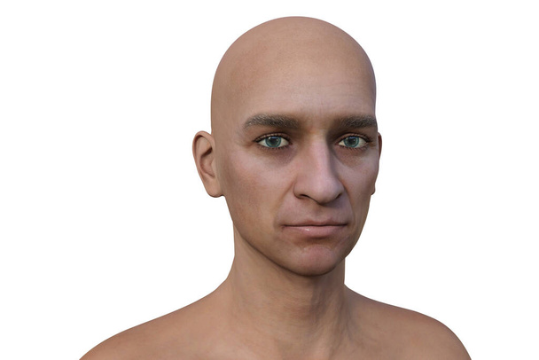 3D ilustrace obličeje muže středního věku, zobrazující složité detaily a texturní prvky stárnoucí pleti - Fotografie, Obrázek