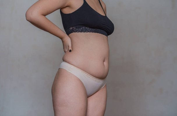 Gerçek kadın vücudu rötuş ve düzeltme yok, sağlık hizmeti, biraz obez ağırlığı, selülit, vücut pozitifliği - Fotoğraf, Görsel