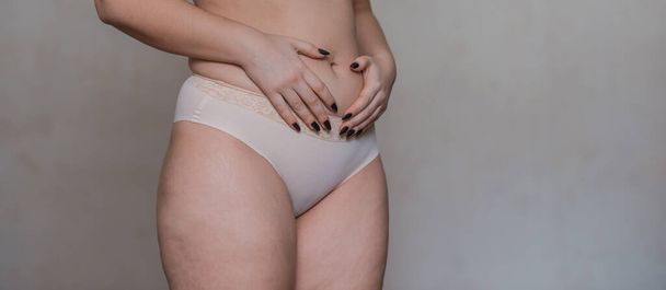 Cuerpo de mujer real sin retoque y correccional, cuidado de la salud, un poco de peso obeso, celulitis, cuerpo positivo - Foto, Imagen