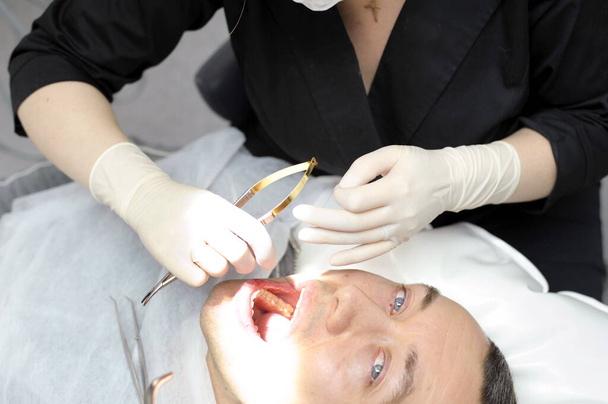 жінка-лікар в чорному одязі в стоматології пришиває рану після операції на зубі, зуб видаляється з чоловіка, він дивиться на неї з маленькими очима, болить його анестезією лікування зубів
 - Фото, зображення