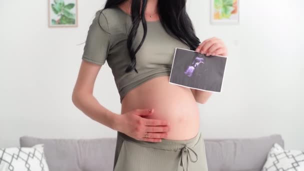embarazo, madre joven sostiene una foto de un ultrasonido cerca de su vientre, primer plano - Imágenes, Vídeo