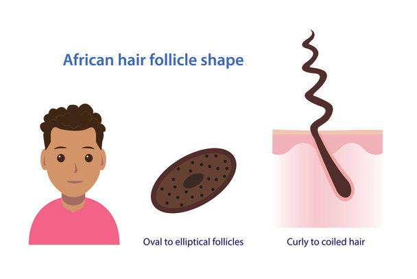 Informace o afrických vlasových folikulů ve tvaru vektorové ilustrace izolované na bílém pozadí. Průřez oválných a eliptických folikulů. Vlnité až zvlněné, kudrnaté, zvlněné vlasy s vrstvou pokožky hlavy. Anatomie vlasů koncept ilustrace. - Vektor, obrázek
