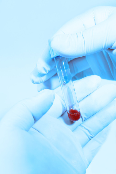 Hand holding blood in test tube take with blue filter - Fotografie, Obrázek