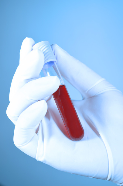 Hand holding blood in test tube take with blue filter - Фото, изображение