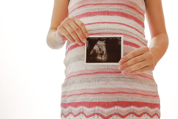 Pregnant woman with ultrasound picture - Foto, Imagem
