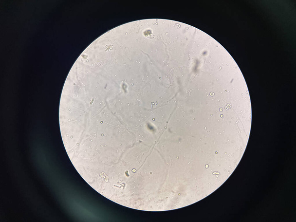 Budding yeast with pseudo hephae in urine laboratory. - Photo, Image