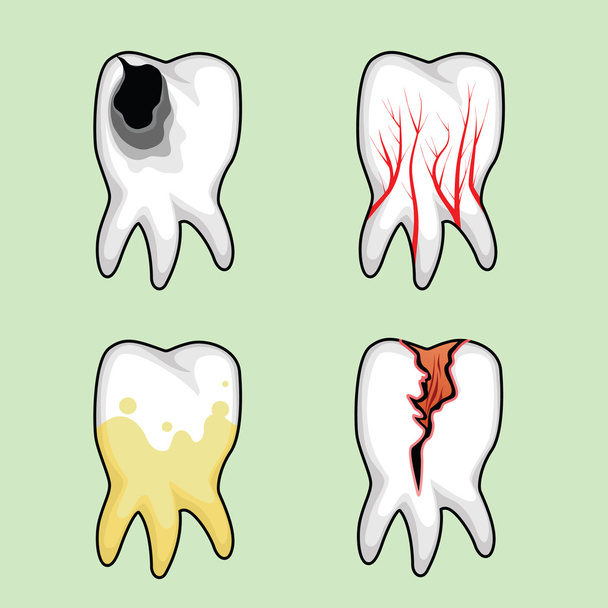 病気歯 - ベクター画像