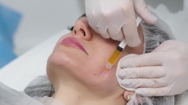 Top view medium close-up shot of platelet rich plasma face injections procedure | PRP Therapy in beauty salon | Young brown-haired female Caucasian patient. - Séquence, vidéo