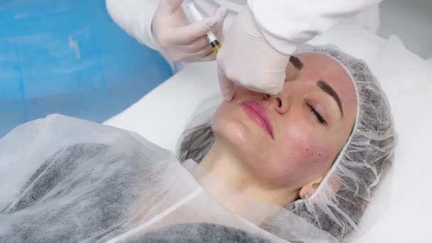 Top view medium close-up shot of platelet rich plasma face injections procedure | PRP Therapy in beauty salon | Young brown-haired female Caucasian patient. - Materiaali, video
