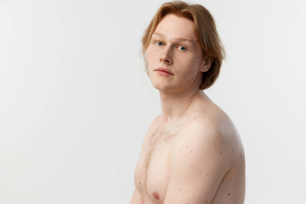 Side view portrait of young redhead man with moles on body posing shirtless over grey studio background. Body-positivity. Concept of mens health, body and skin care, hygiene and male cosmetology - Photo, Image