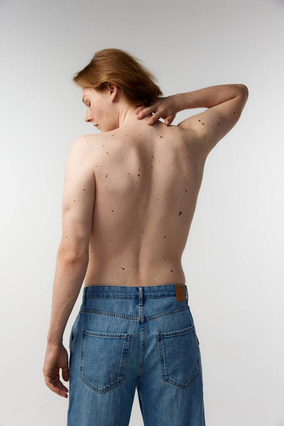 Tylne zdjęcie młodego człowieka pozującego bez koszulki w dżinsach na szarym tle studia. Krety na ciele, zdrowe plecy, kręgosłup. Pojęcie zdrowia mężczyzn, pielęgnacji ciała i skóry, higieny i kosmetologii męskiej - Zdjęcie, obraz