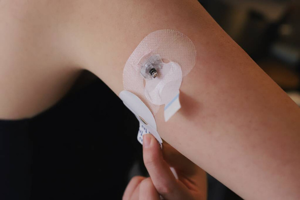Aanbrengen van de sticker voor de bloedglucosesensor  - Foto, afbeelding