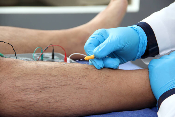 Electromyography in the lower limbs, graphic recording technique of the electrical activity produced by the tibial muscle performed by a specialist neurologist - 写真・画像