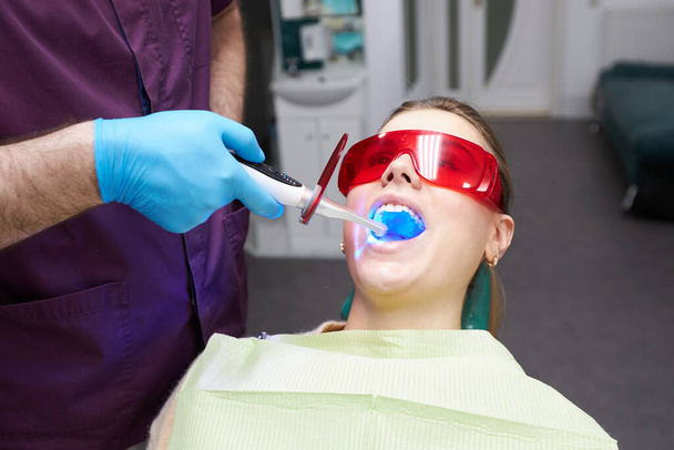 Κοντινό πλάνο γυναίκα με ανοιχτό στόμα κατά τη διάρκεια μιας διαδικασίας λεύκανσης δοντιών στη σύγχρονη οδοντιατρική κλινική. Αισθητική και αισθητική οδοντιατρική. Οδοντιατρική πρακτική. Υγεία του στόματος και υγιεινή. Ανθρώπους. Καταναλωτές. Υπηρεσία - Φωτογραφία, εικόνα