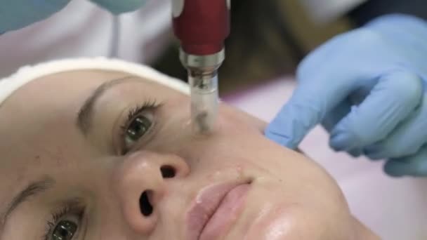 Снимок косметолога, делающего инъекцию мезотерапии дермапена на лице для омоложения в спа, 4k видео. - Кадры, видео