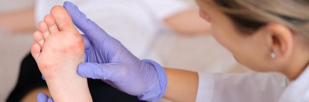 Orvos vizsgálja a gyerek lábát vörös viszkető kiütésekkel a klinikán. Enterovírus fertőzés tünetei kéz-láb-száj fogalom - Fotó, kép