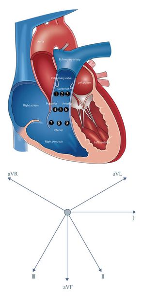 Şekil, sağ ventriküler akış yolunun dokuz bölgesini ve frontal hexaxial referans sistemini gösteriyor. Farklı bölgelerden gelen VT için, QRS dalga şekli biraz farklıdır. - Fotoğraf, Görsel