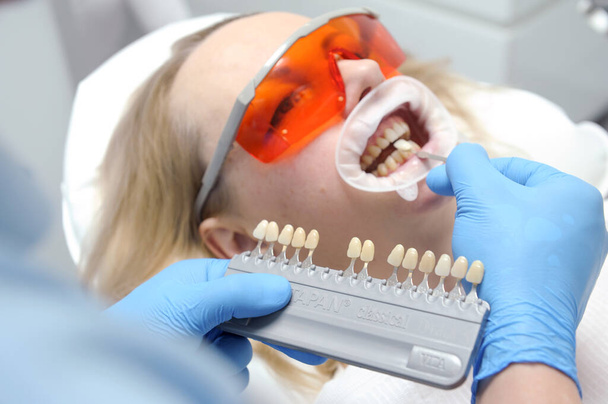 歯の色を決定するための古典的な歯の着色口拡張器の女性を使用して歯の色を取得します。 - 写真・画像