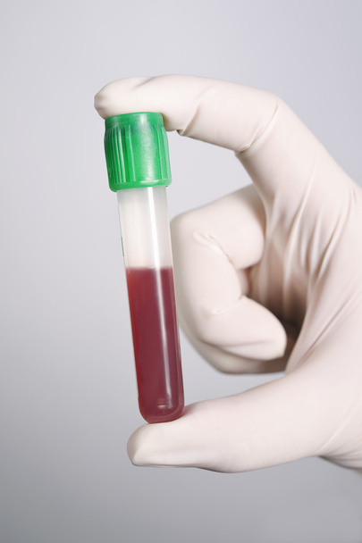 Hand holding blood in test tube - Φωτογραφία, εικόνα