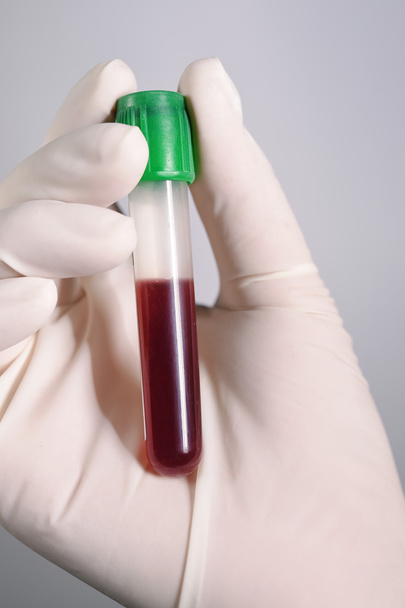 Hand holding blood in test tube - Fotografie, Obrázek