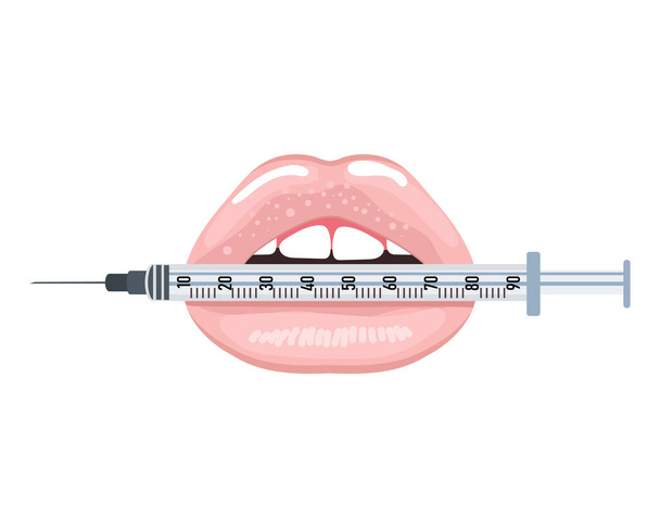 Lips holding a syringe. Beauty concept of lips, lip filler. Medical icon, cosmetology logo. Illustration, vector - Vector, Imagen