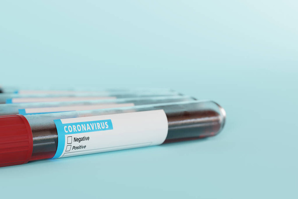 Vzorky krve pro Coronavirus COVID test. Koncept pandemie koronaviru, nová vlna infekcí. Diagnóza COVID. 3D vykreslení, 3D ilustrace. - Fotografie, Obrázek