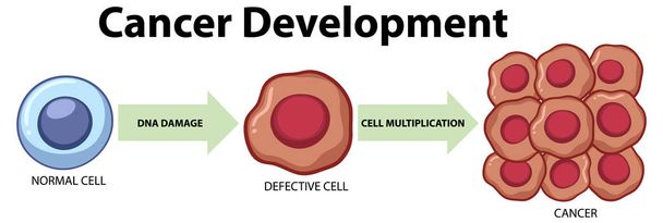 Tumor cell and cancer development illustration - Vector, Image
