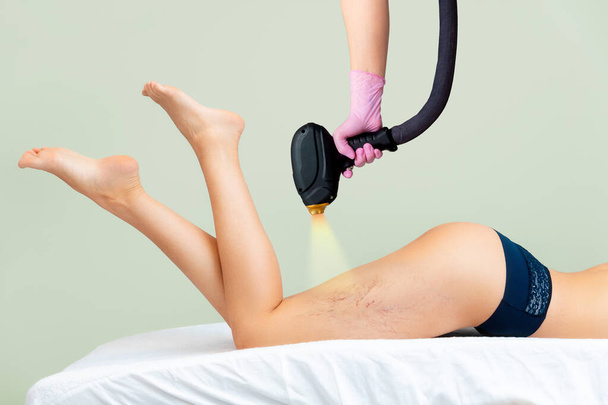 Косметолог в медицинских перчатках держит лазерное устройство рядом с красивыми стройными ногами женщины с тромбозом варикоза. Зеленый фон. Концепция эпиляции и удаления волос. - Фото, изображение