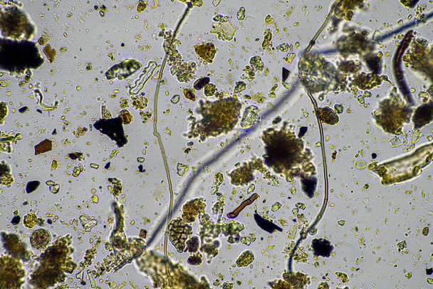 microorganismos del suelo en una muestra de suelo, hongos y bacterias del suelo en una granja regenerativa en compost. hifas de hongos en una prueba de suelo. en Australia - Foto, imagen