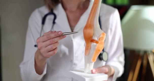 El traumatólogo señaló el área del modelo de articulación de la rodilla. Consultas médicas y ortopédicas - Metraje, vídeo