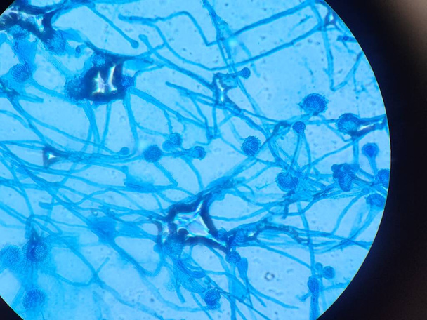 Aspergillus conidiophores - lactophenol cotton blue - Photo, image