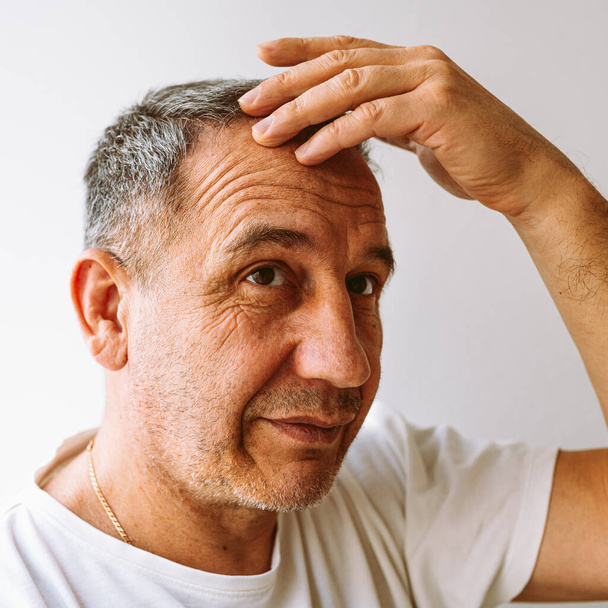 Middle-aged man demonstrates gray hair, hair loss problem, Close-up of face of brown-eyed man, with facial wrinkles, age spots on skin, shows gray hair on head - Foto, Bild