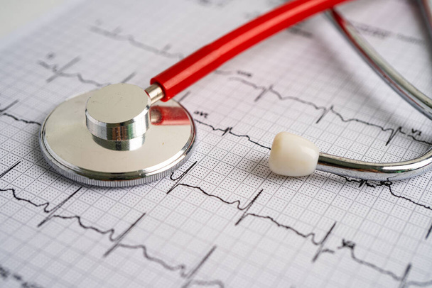 Estetoscopio en electrocardiograma ECG, onda cardíaca, ataque cardíaco, informe de cardiograma. - Foto, imagen