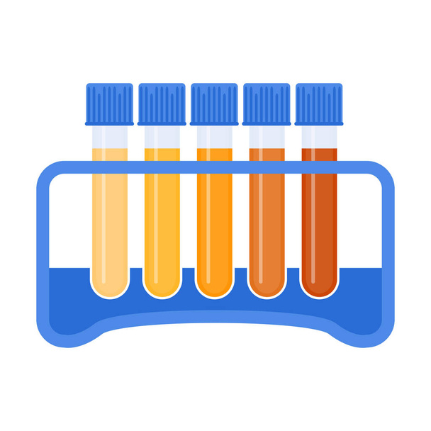 Urine colour chart. Hydration and dehydration level diagram. Medical urinal test kit for urinary tract infection research. Containers with yellow to brown pee for urinalysis. Vector illustration. - Διάνυσμα, εικόνα