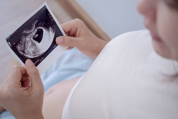 Hamile bir kadın ceninin ultrason fotoğrafına bakıyor. Anne bebeğin karnına hafifçe dokunur. Mutlu, aile, büyüme, gebelik, keyif, yeni doğan, bakım, sağlık, mide. - Fotoğraf, Görsel