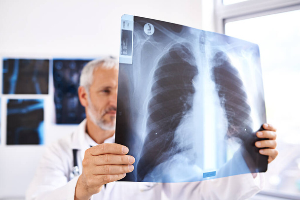 Діагностування проблеми. зрілий чоловік лікар дивиться рентгенівське зображення в лікарні
 - Фото, зображення