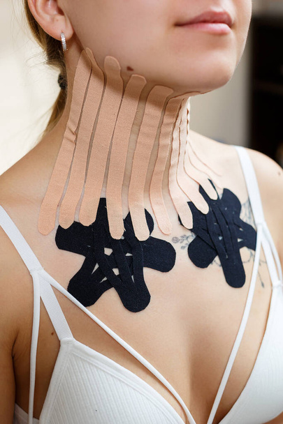 Close-up of a tape on the neck of a young woman. Kinesiotherapy with therapeutic tapes - Foto, Imagem