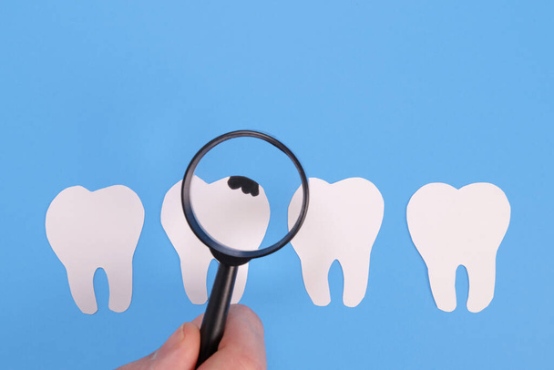 nagyító megvizsgálja a fogsor a papír fogszuvasodás, a koncepció a fogászati problémák, száj fertőzések - Fotó, kép