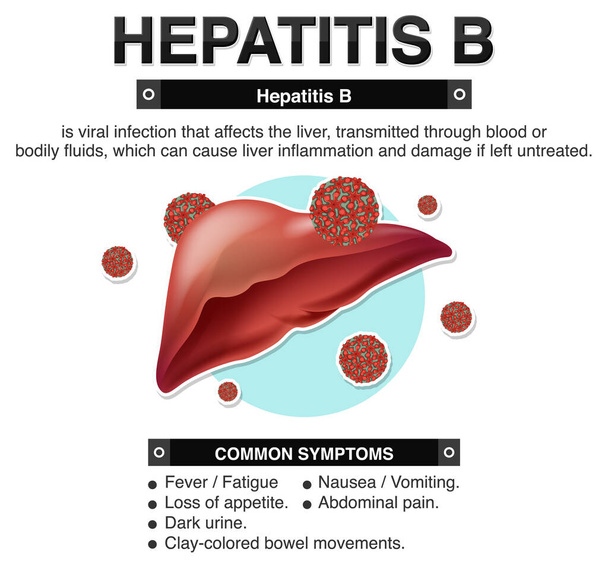 Τα συμπτώματα της ηπατίτιδας Β Infographic εικόνα - Διάνυσμα, εικόνα