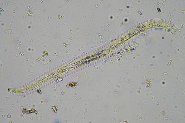 microorganismos y biología del suelo, con nematodos y hongos bajo el microscopio. en una muestra de suelo y compost en Australia - Foto, imagen