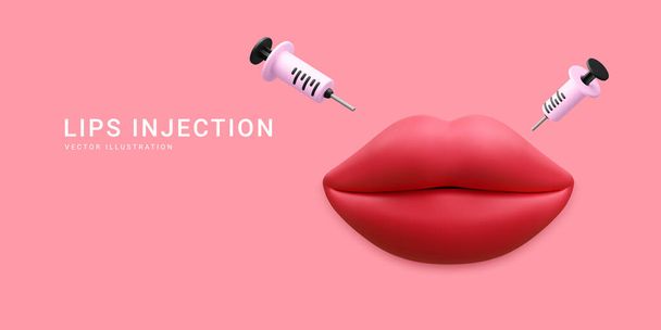 3d realistic banner for lip augmentation procedure. Lips injection of hyaluronic acid. Beauty clinic concept. Vector illustration. - Vector, Image