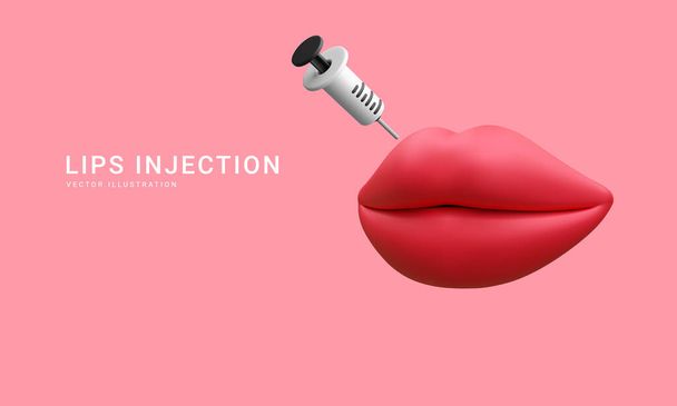 3d realistic banner for lip augmentation procedure. Lips injection of hyaluronic acid. Beauty clinic concept. Vector illustration. - Vector, Image
