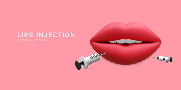 3d realistic banner for lip injection. Concept of dermatology and cosmetology treatment. Red aesthetic beautiful lips with medical plastic syringe with cosmetic injection in cartoon style. - Vector, Image